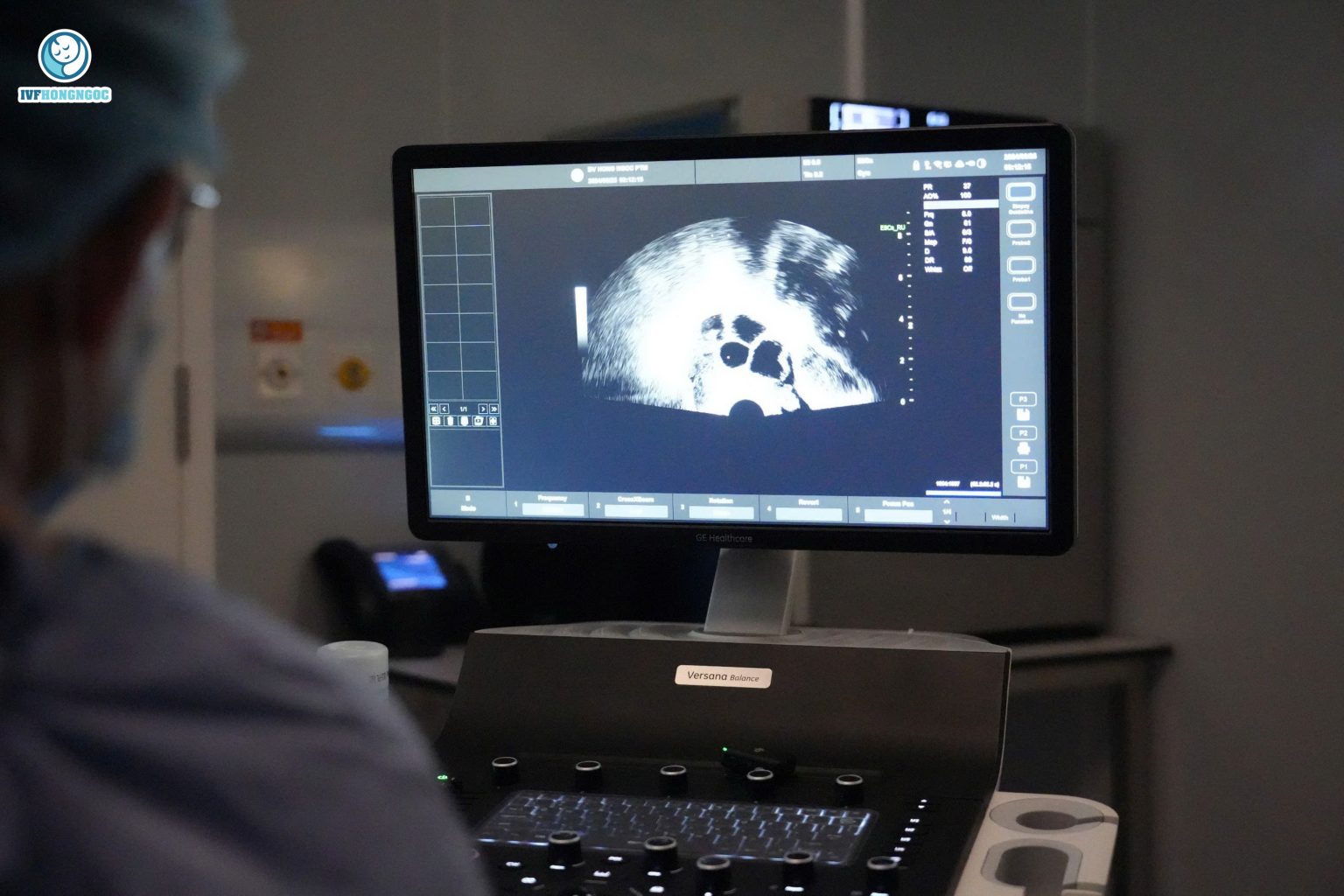 Điều trị cá thể hóa cho từng ca thụ tinh trong ống nghiệm