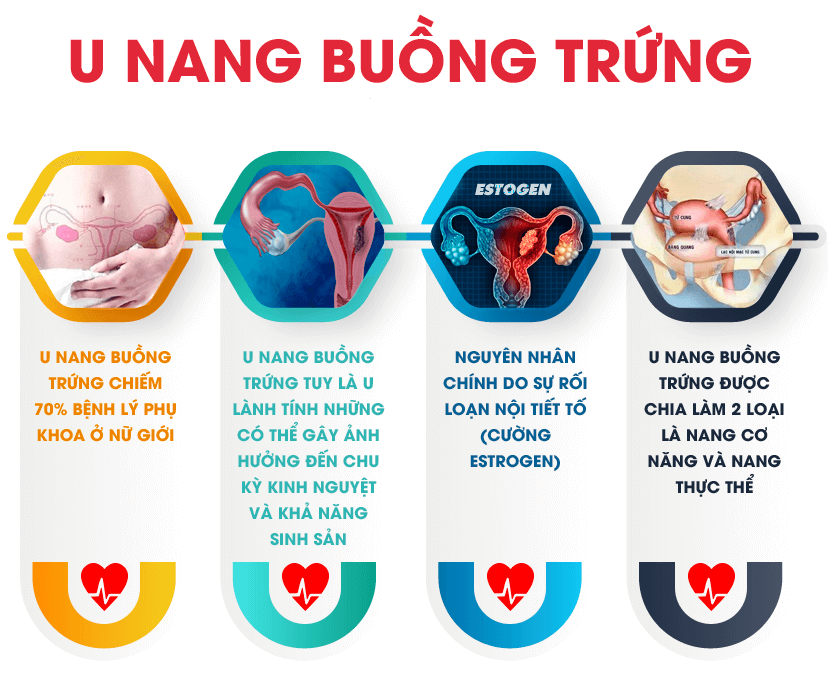 Buồng trứng đa nang có chữa được không