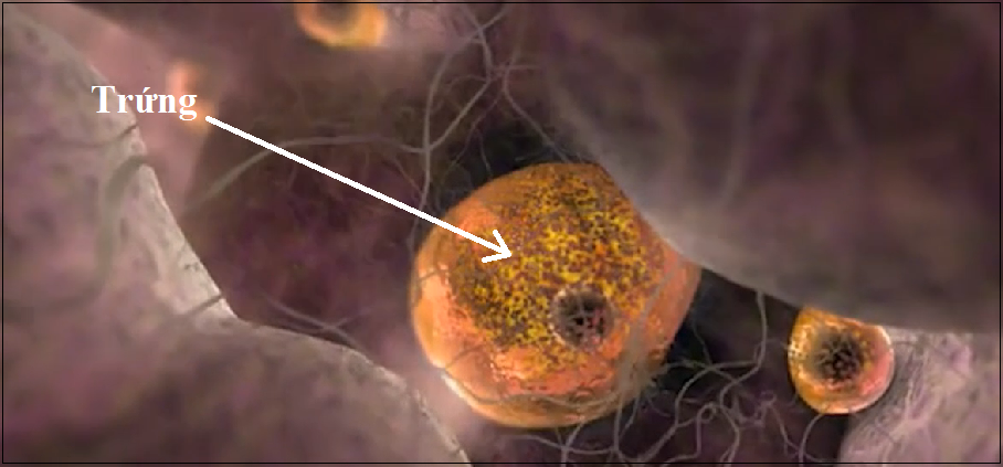 Dấu hiệu suy buồng trứng sớm