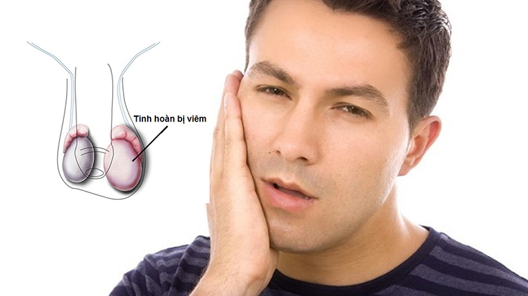 Nguy cơ vô sinh khi mắc bệnh quai bị