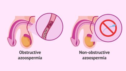 không có tinh trùng