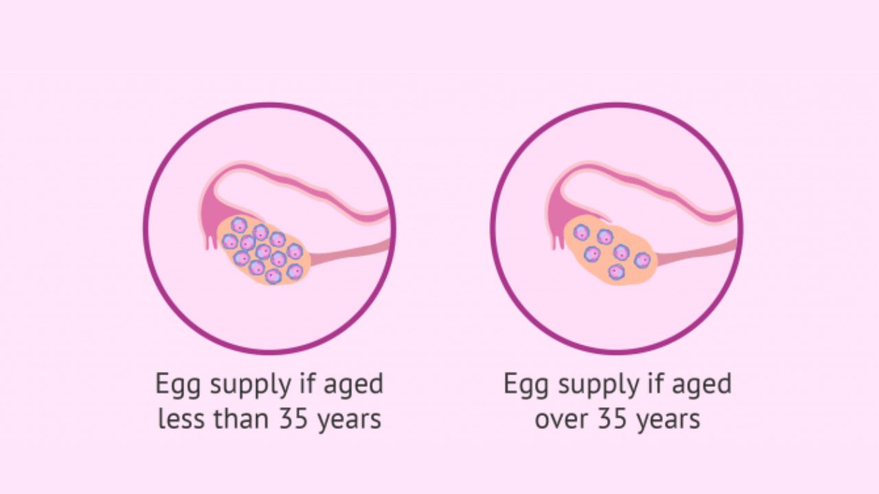 nguyên nhân suy buồng trứng