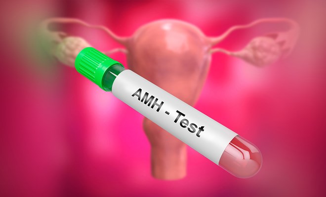 suy giảm chỉ số AMH sớm