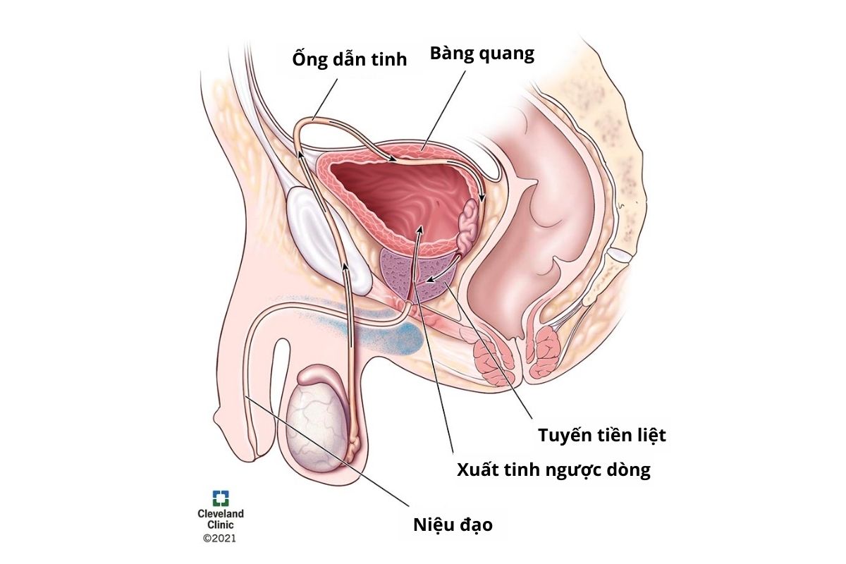 xuất tinh ngược dòng