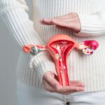 Giảm Dự Trữ Buồng Trứng Có Còn Cơ Hội Làm Mẹ?